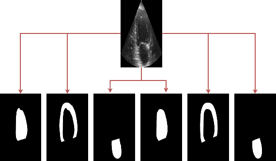 Figure 2 for Two layer Ensemble of Deep Learning Models for Medical Image Segmentation