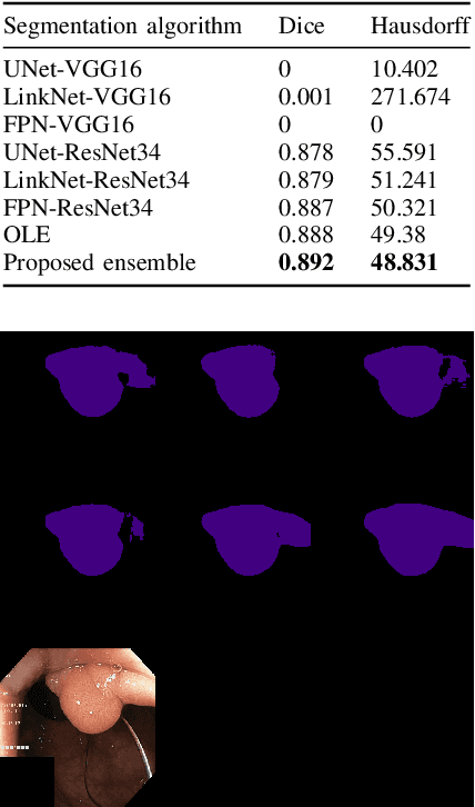 Figure 4 for Two layer Ensemble of Deep Learning Models for Medical Image Segmentation