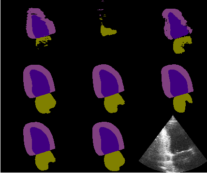 Figure 3 for Two layer Ensemble of Deep Learning Models for Medical Image Segmentation