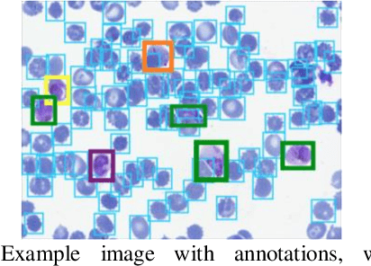 Figure 1 for Applying Faster R-CNN for Object Detection on Malaria Images