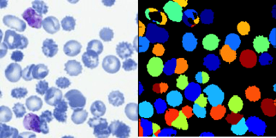 Figure 2 for Applying Faster R-CNN for Object Detection on Malaria Images