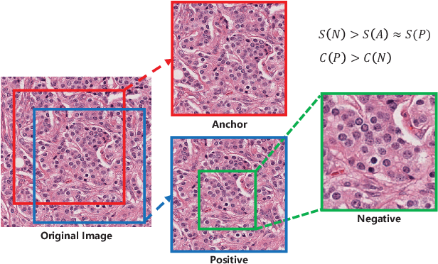 Figure 1 for Instance-aware Self-supervised Learning for Nuclei Segmentation