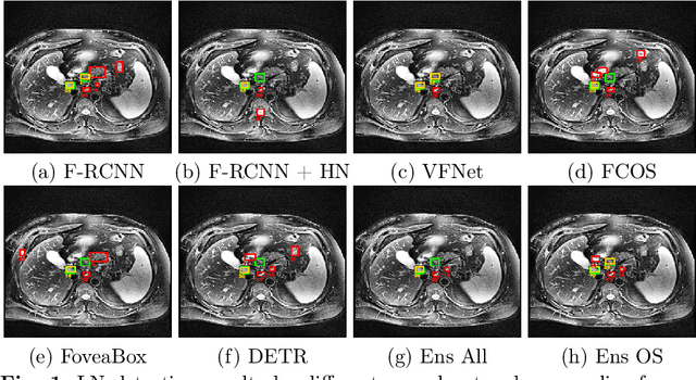 Figure 1 for Universal Lymph Node Detection in T2 MRI using Neural Networks