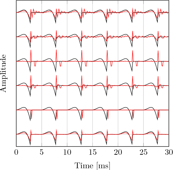 Figure 1 for A Variational EM Method for Pole-Zero Modeling of Speech with Mixed Block Sparse and Gaussian Excitation