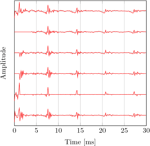 Figure 3 for A Variational EM Method for Pole-Zero Modeling of Speech with Mixed Block Sparse and Gaussian Excitation