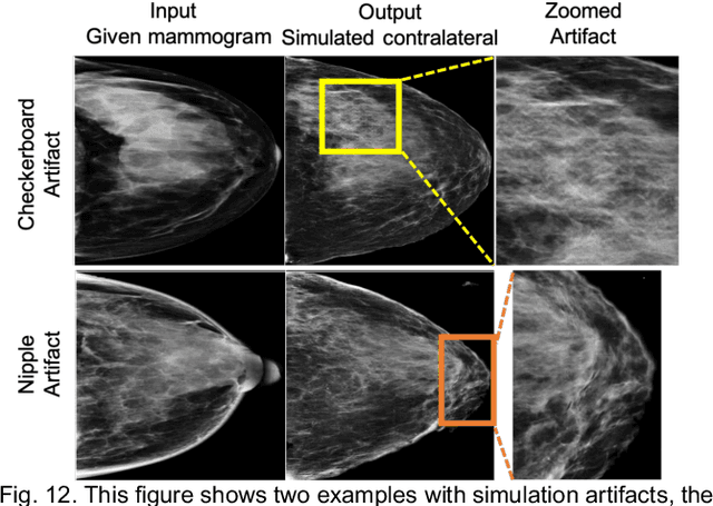 Figure 4 for Identifying Women with Mammographically-Occult Breast Cancer Leveraging GAN-Simulated Mammograms