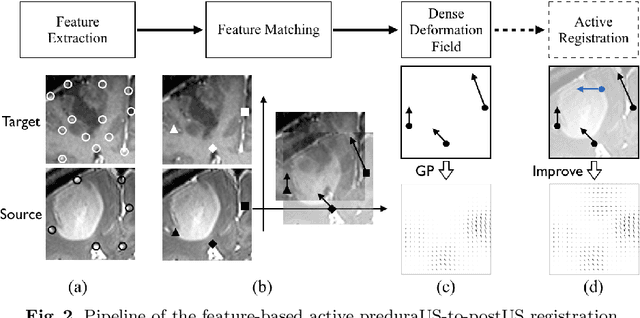 Figure 3 for A Feature-Driven Active Framework for Ultrasound-Based Brain Shift Compensation