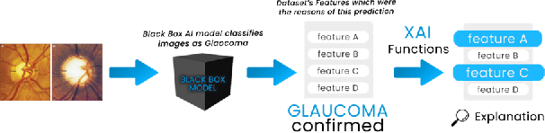 Figure 2 for Explainable AI based Glaucoma Detection using Transfer Learning and LIME