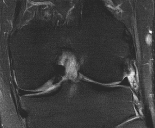 Figure 1 for MRI Banding Removal via Adversarial Training