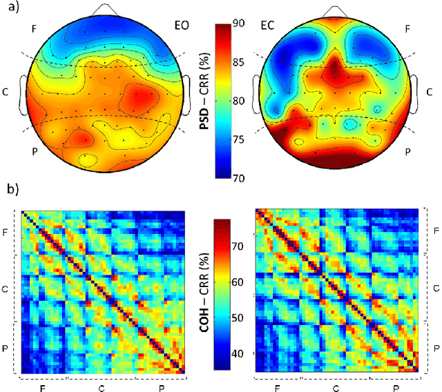 Figure 1 for Human brain distinctiveness based on EEG spectral coherence connectivity