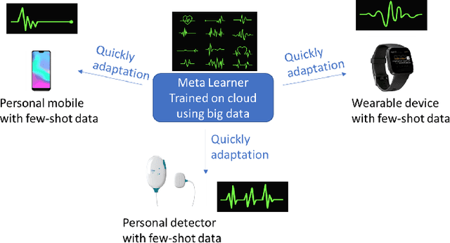 Figure 1 for Interpretable Time-series Classification on Few-shot Samples