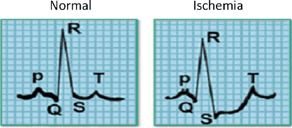 Figure 4 for Interpretable Time-series Classification on Few-shot Samples