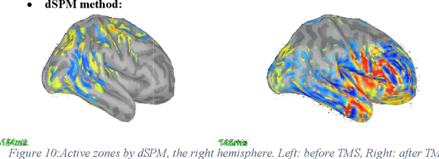 Figure 2 for Comparison of inverse problem linear and non-linear methods for localization source: a combined TMS-EEG study