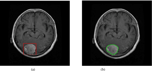 Figure 3 for A Systematic Approach for MRI Brain Tumor Localization, and Segmentation using Deep Learning and Active Contouring