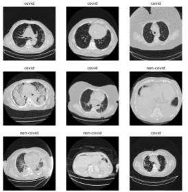 Figure 1 for Custom Deep Neural Network for 3D Covid Chest CT-scan Classification