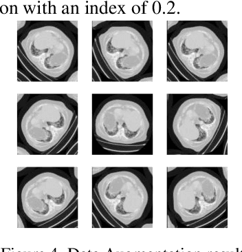 Figure 4 for Custom Deep Neural Network for 3D Covid Chest CT-scan Classification