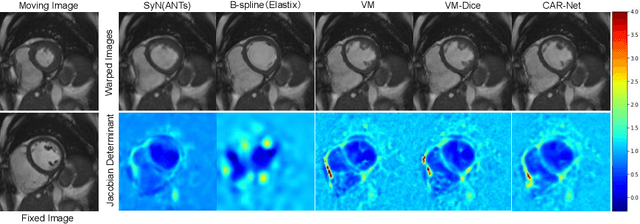 Figure 3 for CAR-Net: Unsupervised Co-Attention Guided Registration Network for Joint Registration and Structure Learning