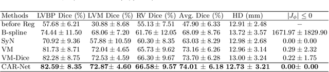 Figure 2 for CAR-Net: Unsupervised Co-Attention Guided Registration Network for Joint Registration and Structure Learning