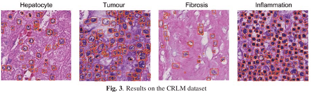 Figure 3 for US-net for robust and efficient nuclei instance segmentation