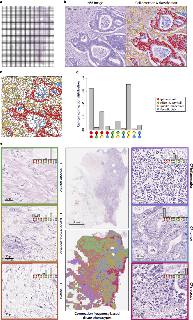 Figure 2 for Novel digital tissue phenotypic signatures of distant metastasis in colorectal cancer