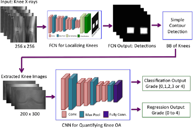 Figure 3 for Automatic Detection of Knee Joints and Quantification of Knee Osteoarthritis Severity using Convolutional Neural Networks
