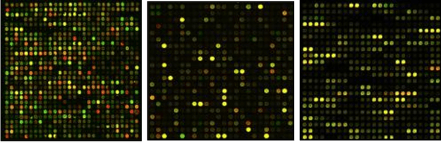 Figure 3 for Robust cDNA microarray image segmentation and analysis technique based on Hough circle transform