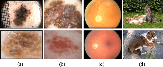 Figure 1 for Knowledge Transfer for Melanoma Screening with Deep Learning