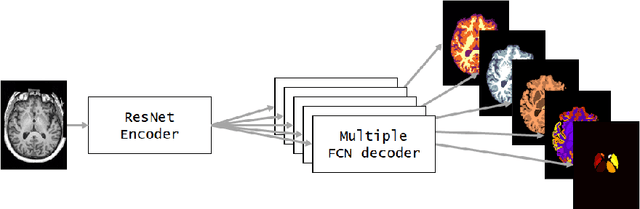 Figure 3 for NeuroNet: Fast and Robust Reproduction of Multiple Brain Image Segmentation Pipelines
