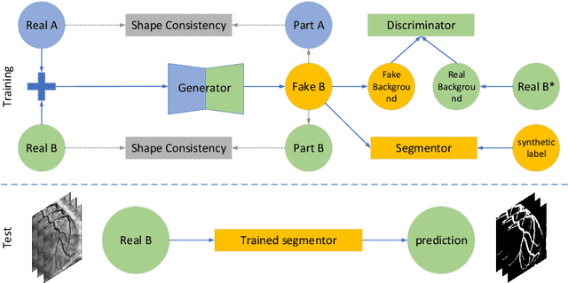 Figure 1 for Annotation-Free Cardiac Vessel Segmentation via Knowledge Transfer from Retinal Images