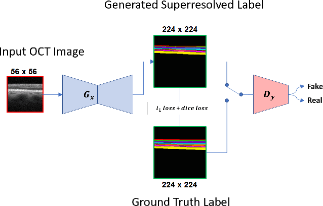 Figure 1 for GAN-based Super-Resolution and Segmentation of Retinal Layers in Optical coherence tomography Scans