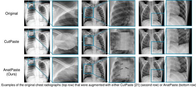Figure 1 for Anatomy-aware Self-supervised Learning for Anomaly Detection in Chest Radiographs