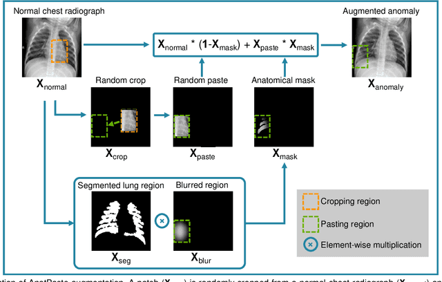 Figure 2 for Anatomy-aware Self-supervised Learning for Anomaly Detection in Chest Radiographs