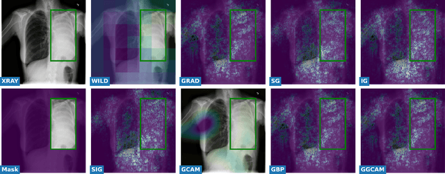 Figure 2 for Towards Trainable Saliency Maps in Medical Imaging