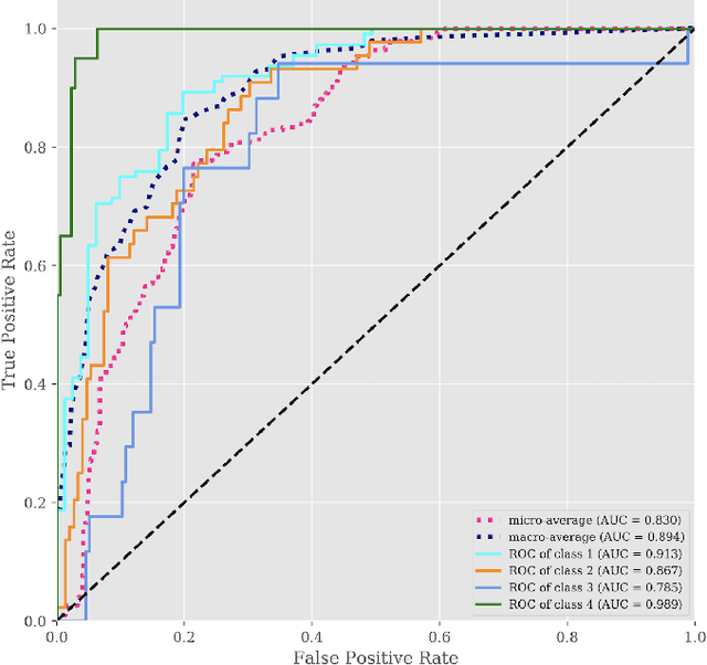 Figure 4 for Deep Learning Based Unsupervised and Semi-supervised Classification for Keratoconus