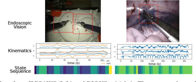 Figure 1 for daVinciNet: Joint Prediction of Motion and Surgical State in Robot-Assisted Surgery