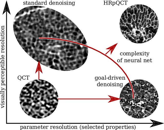 Figure 1 for Noise Reduction to Compute Tissue Mineral Density and Trabecular Bone Volume Fraction from Low Resolution QCT