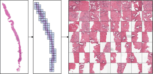 Figure 1 for Accounting for Dependencies in Deep Learning Based Multiple Instance Learning for Whole Slide Imaging