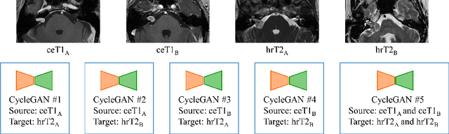 Figure 1 for Enhancing Data Diversity for Self-training Based Unsupervised Cross-modality Vestibular Schwannoma and Cochlea Segmentation