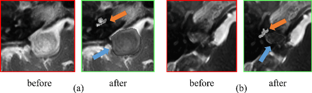 Figure 2 for Enhancing Data Diversity for Self-training Based Unsupervised Cross-modality Vestibular Schwannoma and Cochlea Segmentation