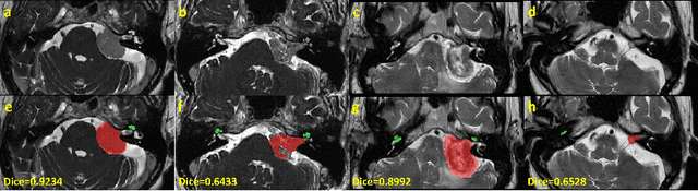 Figure 3 for Enhancing Data Diversity for Self-training Based Unsupervised Cross-modality Vestibular Schwannoma and Cochlea Segmentation