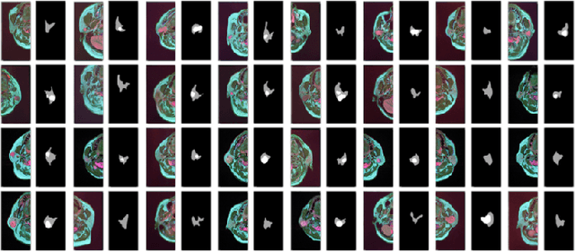 Figure 2 for Parotid Gland MR Image Segmentation Based on Contrastive Learning
