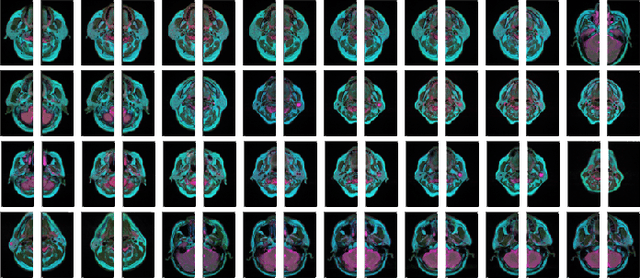 Figure 3 for Parotid Gland MR Image Segmentation Based on Contrastive Learning