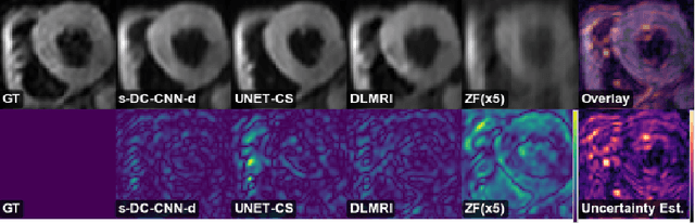Figure 2 for Stochastic Deep Compressive Sensing for the Reconstruction of Diffusion Tensor Cardiac MRI