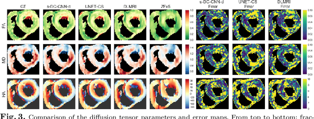Figure 3 for Stochastic Deep Compressive Sensing for the Reconstruction of Diffusion Tensor Cardiac MRI