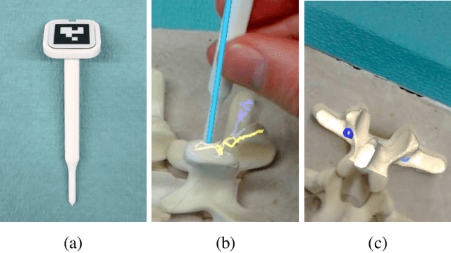 Figure 1 for Registration made easy -- standalone orthopedic navigation with HoloLens