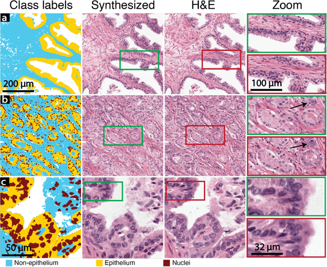 Figure 1 for Deepfake histological images for enhancing digital pathology