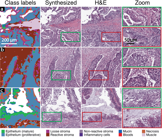 Figure 4 for Deepfake histological images for enhancing digital pathology