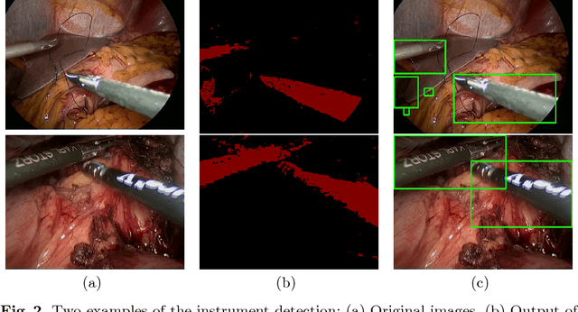 Figure 2 for Real-time image-based instrument classification for laparoscopic surgery