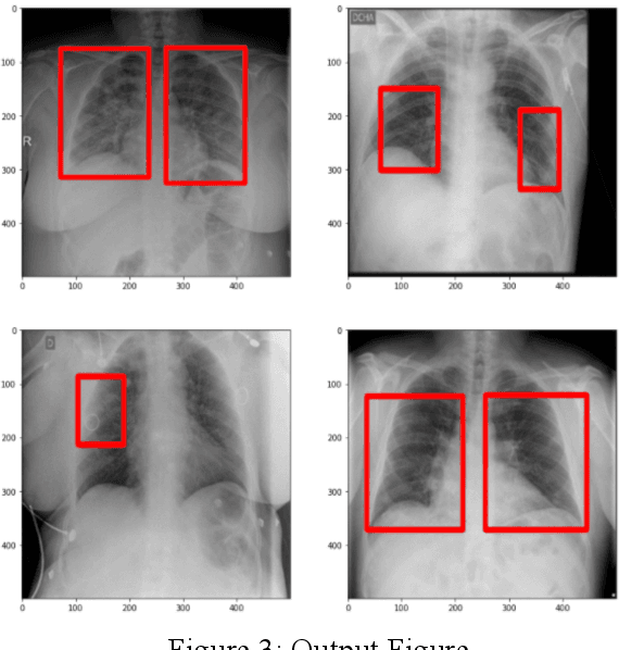 Figure 3 for COVID-19 Detection Using CT Image Based On YOLOv5 Network