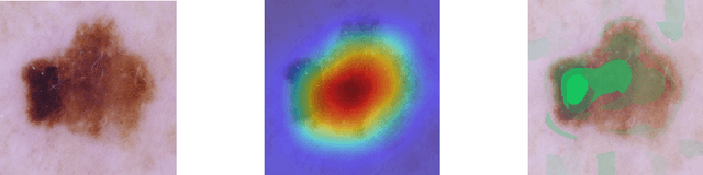 Figure 1 for Deep neural network or dermatologist?